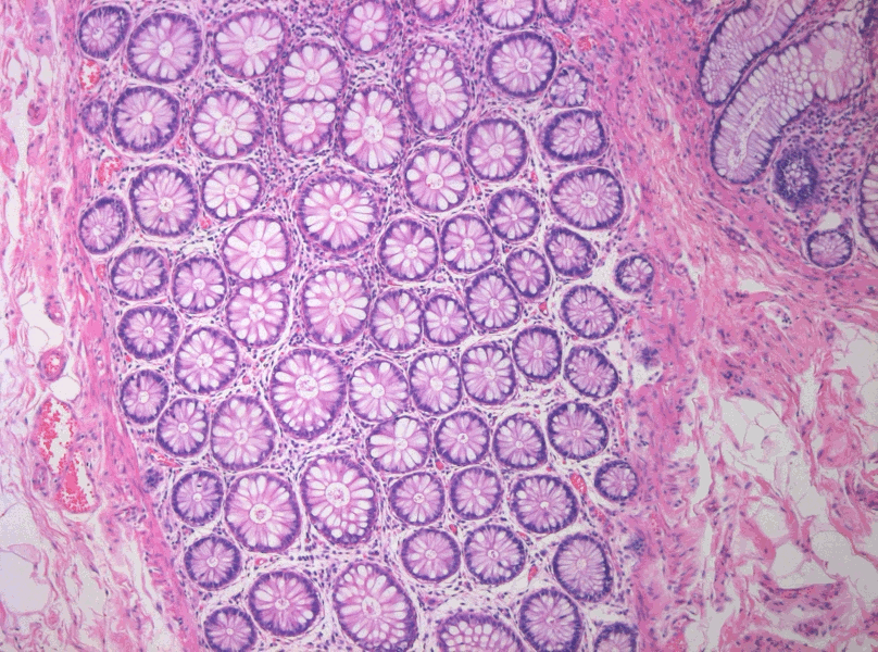 Colon section SRCvi.png