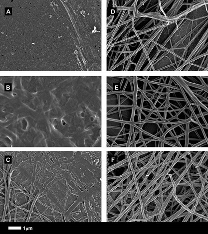 F_Blood clots before and after treatment_Image_ Resia Pretorius.jpg